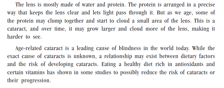 cataract | divinewellnesshealth