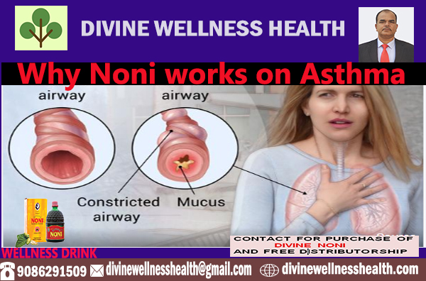 अस्थमा क्या है(Asthma Kya Hai Hindi Me) | divinewellnesshealth