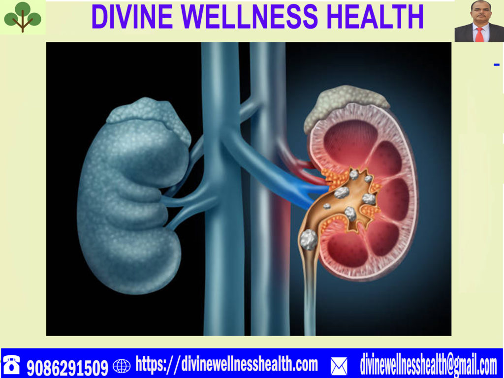 Kidney Kaise Kam Karta Hai-हिन्दी में | divinewellnesshealth